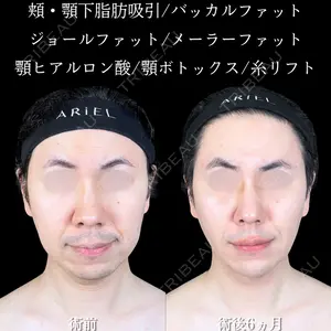 アリエル美容クリニック 大宮院 鈴木　桂介医師の症例