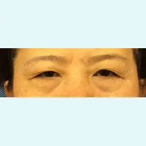 新宿美容外科クリニック 新宿院 井上 淳医師の症例