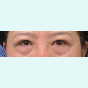新宿美容外科クリニック 新宿院 井上 淳医師の症例
