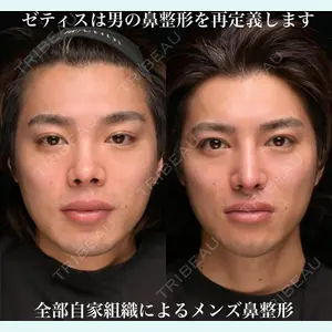 Zetith Beauty Clinic 銀座院 鉄 鑠医師の症例