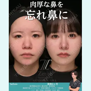 Zetith Beauty Clinic 銀座院 小川 悟史医師の症例