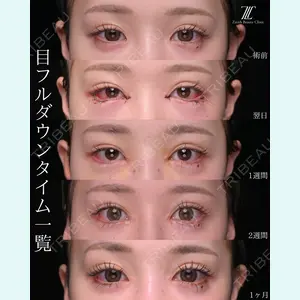 Zetith Beauty Clinic 大阪心斎橋院 楠本 拓哉医師の症例