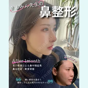 Zetith Beauty Clinic 銀座院 橘　澄医師の症例