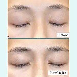 聖心美容クリニック 六本木院 星野 善允医師の症例