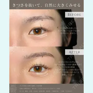 症例