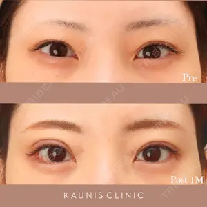 KAUNIS CLINIC（カウニスクリニック） 高野 敏郎医師の症例