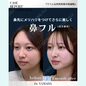 春山記念病院 山田 浩之医師の症例