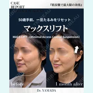 春山記念病院 山田 浩之医師の症例