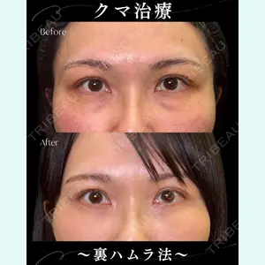 症例