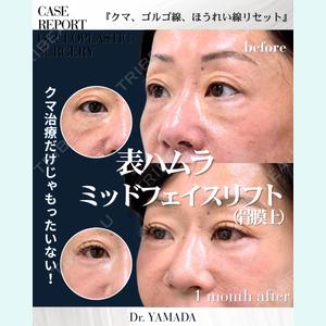 症例