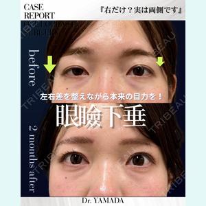 症例