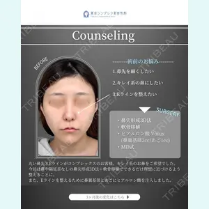 東京シンデレラ美容外科 新宿院 吉原 伯医師の症例