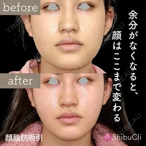 渋谷美容外科クリニック 渋谷院の症例