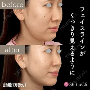 渋谷美容外科クリニック 渋谷院の症例