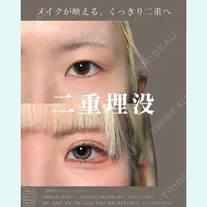 症例