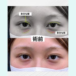症例