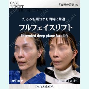 症例