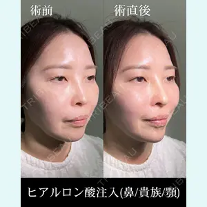 HAAB×DREAM BEAUTY CLINIC 大阪梅田院 柏木 太雅医師の症例