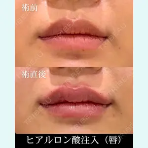 HAAB×DREAM BEAUTY CLINIC 東京本院 齋藤 丈瑠医師の症例