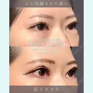 症例