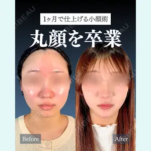 神戸美容外科 ネビュラクリニック 岩﨑 雅医師の症例