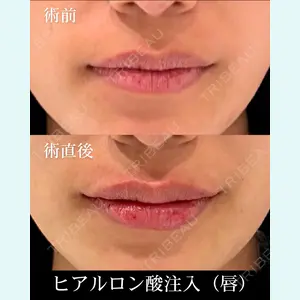 HAAB×DREAM BEAUTY CLINIC 東京本院 齋藤 丈瑠医師の症例