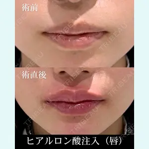 HAAB×DREAM BEAUTY CLINIC 東京本院 齋藤 丈瑠医師の症例