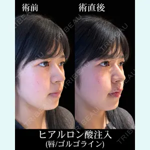 HAAB×DREAM BEAUTY CLINIC 東京本院 佐野 圭医師の症例