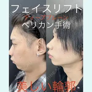 症例