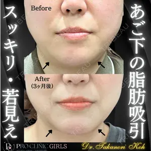 PRO CLINIC プロクリニック 銀座院 洪 嵩典医師の症例