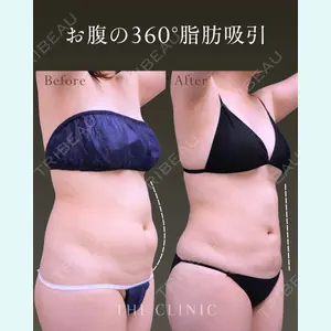 THE CLINIC（ザ・クリニック） 大阪院 黒澤 学医師の症例