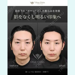 Otus Clinic 【オータスクリニック】 中 徳太郎医師の症例