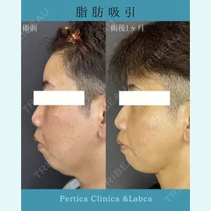 Pertica Clinica & Labcaの症例