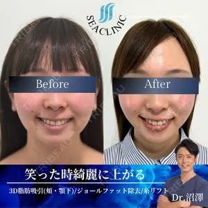SEA CLINIC（シークリニック） 沼澤 茂医師の症例