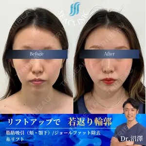 SEA CLINIC（シークリニック） 沼澤 茂医師の症例