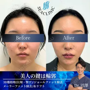 SEA CLINIC（シークリニック） 沼澤 茂医師の症例
