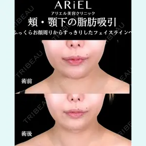 アリエル美容クリニック 横浜院 加藤 敏次医師の症例