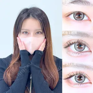 アリエル美容クリニック 大宮院 江郷隼一郎医師の症例