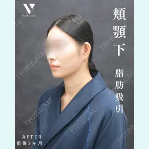 症例
