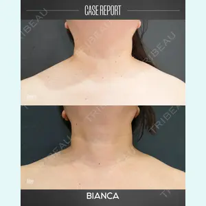 BIANCA銀座 葉山 愛弥医師の症例