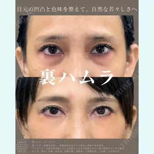 症例
