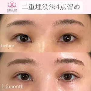 オーキッド美容クリニック東京御徒町 西浦 蘭子医師の症例