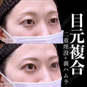 EMMO FACE CLINIC 大宮院 百瀬 直也医師の症例
