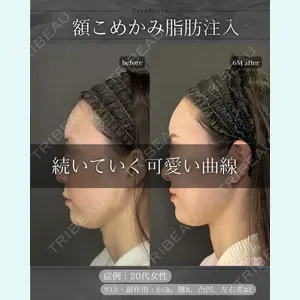 症例