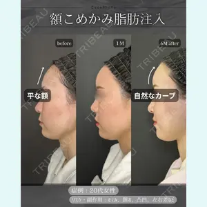 症例