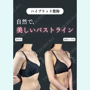 症例