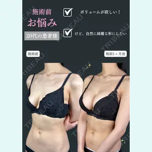 症例