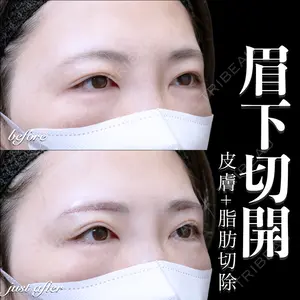 EMMO FACE CLINIC 大宮院 百瀬 直也医師の症例