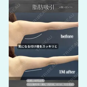 症例