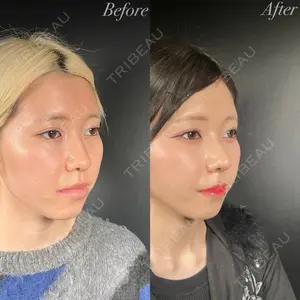 R Beauty CLINIC 大阪院 小池 泰弘医師の症例
